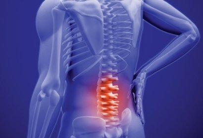 LOMBALGIA: 7 SINAIS DE ALERTA NA DOR LOMBAR