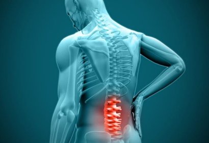 HÉRNIA DE DISCO: CAUSAS, SINTOMAS E TRATAMENTOS